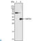 Fyn Related Src Family Tyrosine Kinase antibody, LS-C812756, Lifespan Biosciences, Western Blot image 