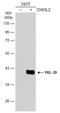 Chitinase 3 Like 2 antibody, GTX114322, GeneTex, Western Blot image 