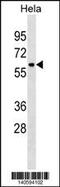 Zinc Finger Protein 410 antibody, 60-545, ProSci, Western Blot image 