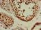 Microtubule Associated Protein 1 Light Chain 3 Beta antibody, LS-C678554, Lifespan Biosciences, Immunohistochemistry paraffin image 