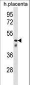 Clusterin Like 1 antibody, LS-C159374, Lifespan Biosciences, Western Blot image 