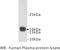 Transthyretin antibody, MBS355095, MyBioSource, Western Blot image 