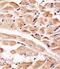 Serine/threonine-protein kinase PINK1, mitochondrial antibody, M00201, Boster Biological Technology, Immunohistochemistry paraffin image 