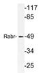 ArfGAP With FG Repeats 2 antibody, AP21188PU-N, Origene, Western Blot image 