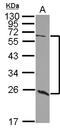 Polypeptide N-Acetylgalactosaminyltransferase 9 antibody, LS-C155524, Lifespan Biosciences, Western Blot image 
