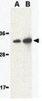 STE20 Related Adaptor Beta antibody, GTX31282, GeneTex, Western Blot image 