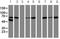 Arachidonate 15-Lipoxygenase antibody, ab119774, Abcam, Western Blot image 