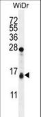 Translocase Of Outer Mitochondrial Membrane 20 Like antibody, LS-C160108, Lifespan Biosciences, Western Blot image 