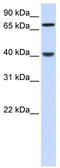 PDZ And LIM Domain 3 antibody, TA334543, Origene, Western Blot image 