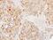 Docking Protein 1 antibody, NBP2-16210, Novus Biologicals, Immunohistochemistry paraffin image 