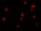 Lysine Demethylase 6B antibody, NBP2-82107, Novus Biologicals, Immunocytochemistry image 