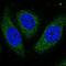 Aspartate Beta-Hydroxylase antibody, HPA055161, Atlas Antibodies, Immunofluorescence image 