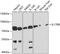 Interleukin 17 Receptor B antibody, GTX64417, GeneTex, Western Blot image 