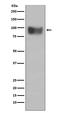 Interferon Alpha And Beta Receptor Subunit 1 antibody, M00306, Boster Biological Technology, Western Blot image 
