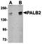 Partner And Localizer Of BRCA2 antibody, orb75244, Biorbyt, Western Blot image 