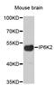 Inositol Hexakisphosphate Kinase 2 antibody, STJ24216, St John