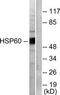 Heat Shock Protein Family D (Hsp60) Member 1 antibody, TA311958, Origene, Western Blot image 