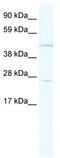 Homeobox B13 antibody, TA341780, Origene, Western Blot image 