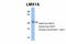 LIM Homeobox Transcription Factor 1 Alpha antibody, 27-470, ProSci, Western Blot image 