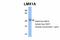 LMX1A antibody, 27-470, ProSci, Western Blot image 