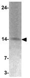 TGFB1-Induced Anti-Apoptotic Factor 1 antibody, GTX31535, GeneTex, Western Blot image 