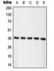 Nucleophosmin 1 antibody, MBS820676, MyBioSource, Western Blot image 