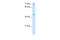 Cytochrome C Oxidase Assembly Homolog COX15 antibody, 30-203, ProSci, Immunohistochemistry paraffin image 