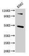Arrestin Beta 1 antibody, CSB-PA002134LA01HU, Cusabio, Western Blot image 