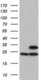 ATP Synthase Peripheral Stalk Subunit OSCP antibody, LS-C339232, Lifespan Biosciences, Western Blot image 
