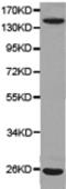 CD51/CD61 antibody, TA323922, Origene, Western Blot image 