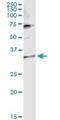 Tetratricopeptide Repeat Domain 1 antibody, H00007265-D01P, Novus Biologicals, Western Blot image 