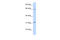 Rho GTPase Activating Protein 25 antibody, 27-164, ProSci, Western Blot image 