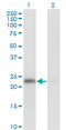 Mitotic Arrest Deficient 2 Like 1 antibody, LS-C197635, Lifespan Biosciences, Western Blot image 