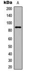 GIT ArfGAP 2 antibody, MBS8207516, MyBioSource, Western Blot image 