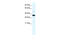 Annexin A3 antibody, 28-515, ProSci, Western Blot image 