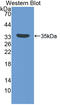 Insulin Like Growth Factor Binding Protein 5 antibody, LS-C717963, Lifespan Biosciences, Western Blot image 