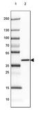 ADP-Ribosylhydrolase Like 1 antibody, PA5-64278, Invitrogen Antibodies, Western Blot image 