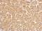 Hydroxysteroid 11-Beta Dehydrogenase 1 antibody, GTX104626, GeneTex, Immunohistochemistry paraffin image 