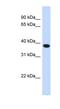 Acyl-CoA Binding Domain Containing 4 antibody, NBP1-59995, Novus Biologicals, Western Blot image 