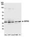 SRP Receptor Subunit Beta antibody, A305-440A, Bethyl Labs, Western Blot image 