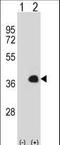 Mesenchyme Homeobox 1 antibody, LS-C164137, Lifespan Biosciences, Western Blot image 
