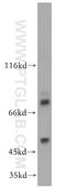 Forkhead Box A1 antibody, 20411-1-AP, Proteintech Group, Western Blot image 