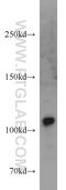 Ubiquitin Specific Peptidase 11 antibody, 22340-1-AP, Proteintech Group, Western Blot image 