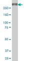 Ubiquitin Specific Peptidase 9 X-Linked antibody, H00008239-M01, Novus Biologicals, Western Blot image 