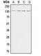 Adenylate Cyclase 5 antibody, MBS820420, MyBioSource, Western Blot image 