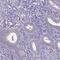 Spectrin Beta, Non-Erythrocytic 4 antibody, PA5-60406, Invitrogen Antibodies, Immunohistochemistry paraffin image 