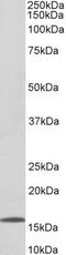 Adaptor Related Protein Complex 2 Subunit Alpha 1 antibody, 43-204, ProSci, Immunohistochemistry frozen image 