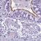 Enkurin, TRPC Channel Interacting Protein antibody, PA5-63969, Invitrogen Antibodies, Immunohistochemistry paraffin image 