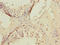 Kruppel Like Factor 9 antibody, LS-C675955, Lifespan Biosciences, Immunohistochemistry paraffin image 