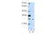 Zinc Finger Protein 397 antibody, 29-106, ProSci, Western Blot image 